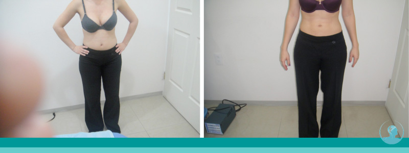 Testimonio Belleza
