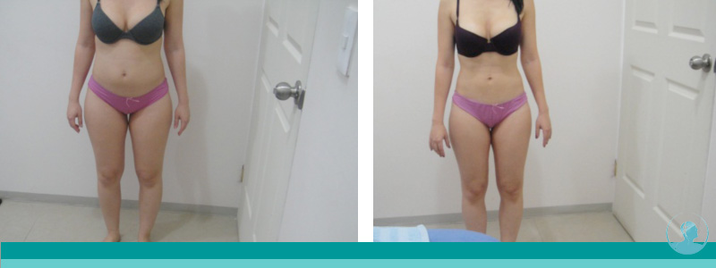 Testimonio Belleza