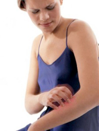 Tipos Psoriasis